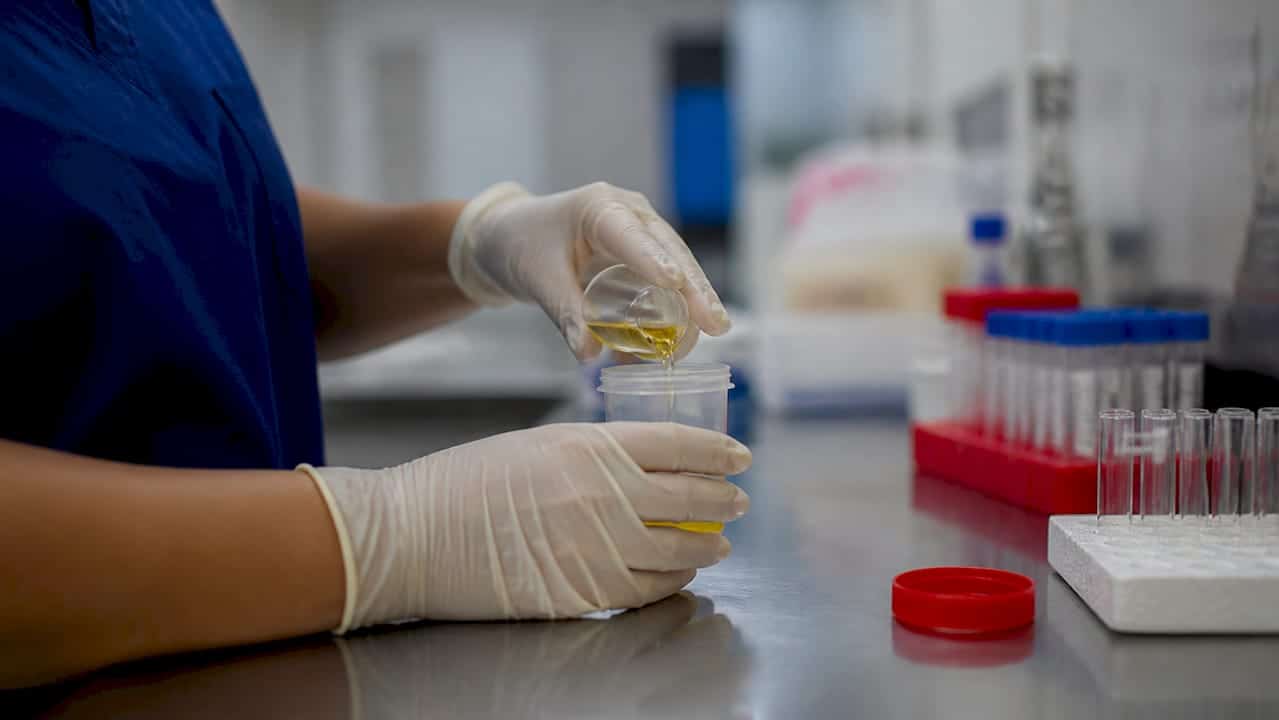 Hand pouring urine sample into collection cup