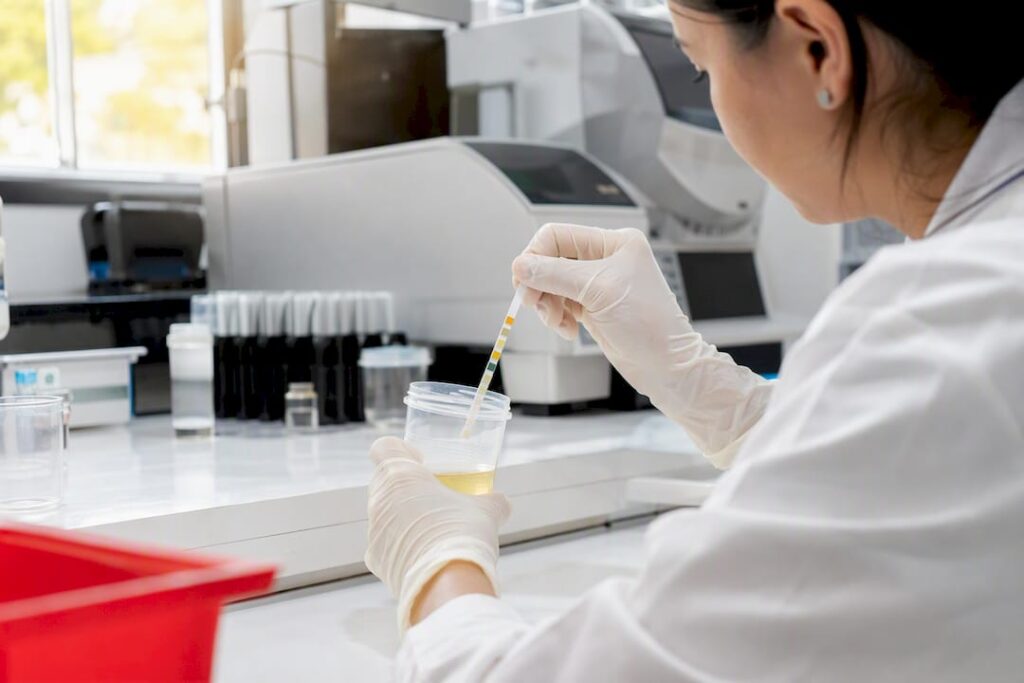 Hands dipping immunoassay strip into urine sample
