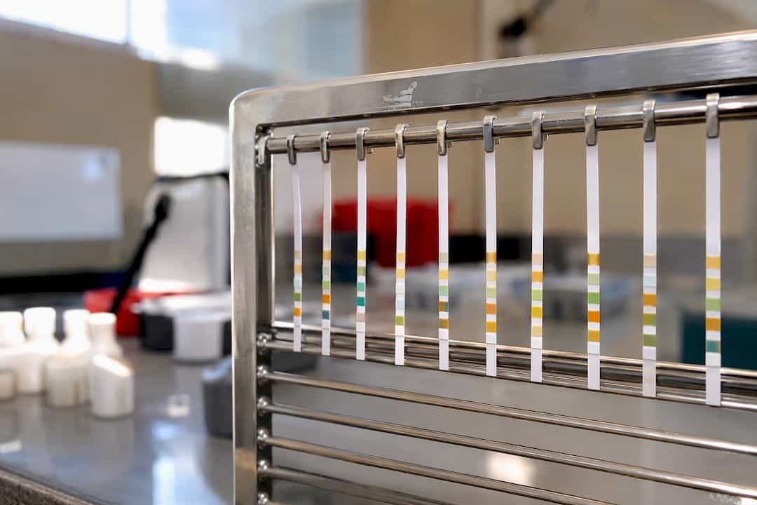 Urine test strips drying in lab