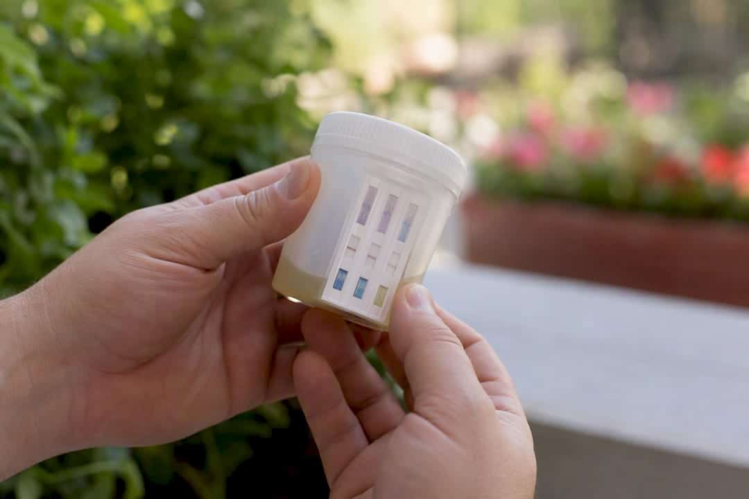 Urine test cup showing drug screen result panel