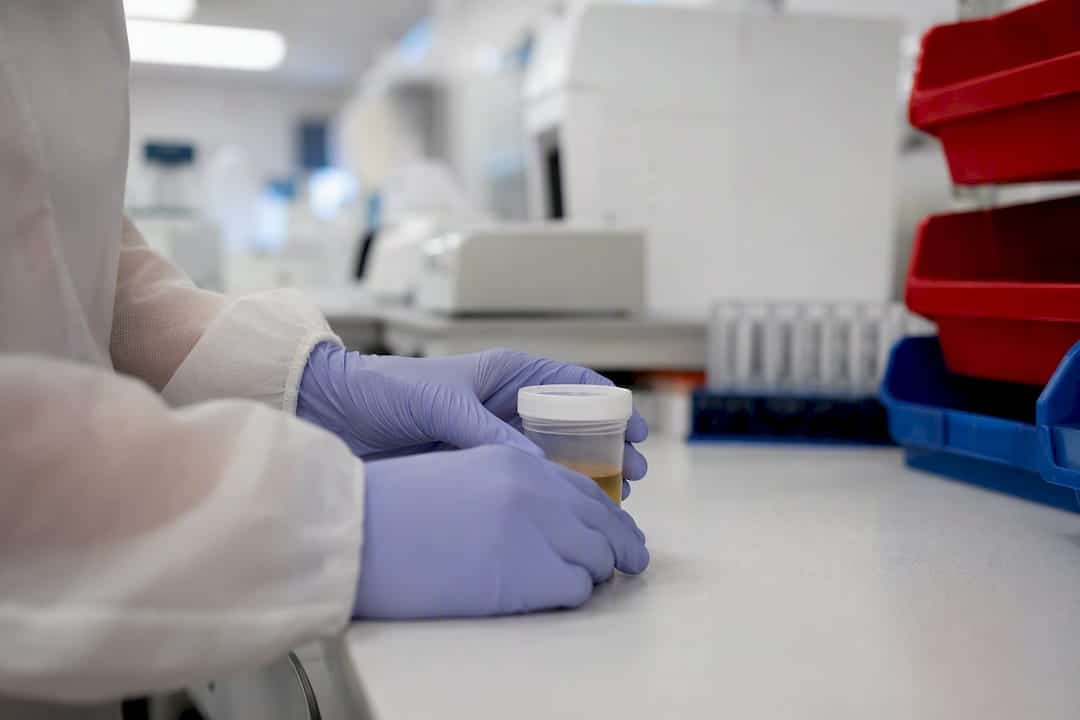 Hands placing specimen cup in clinical setting