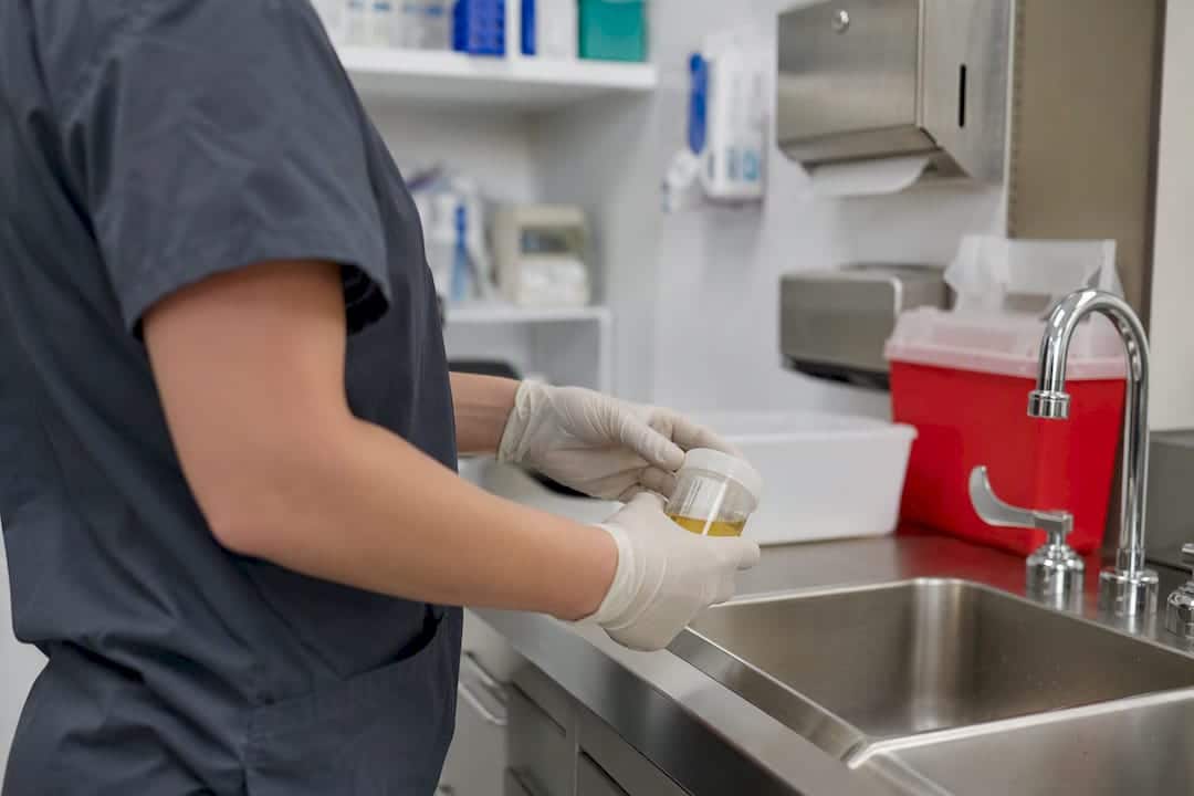 Hands holding urine specimen cup in clinic
