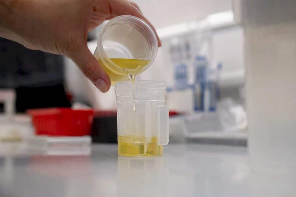 Close-up of urine sample pouring into test cup