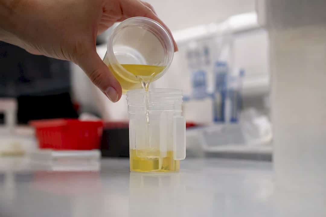 Close-up of urine sample pouring into test cup