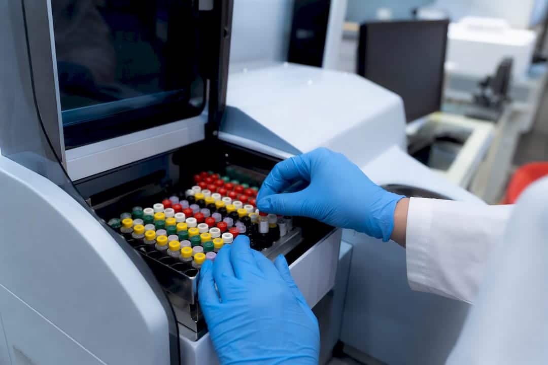 Hands handling metabolite test samples