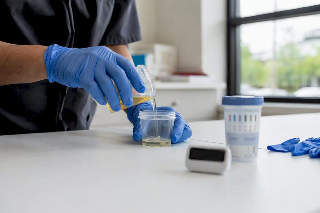 Hands pouring urine into a specimen cup