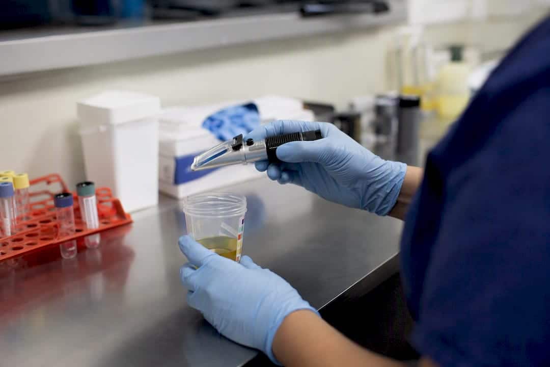 Hands testing urine specimen for dilution markers