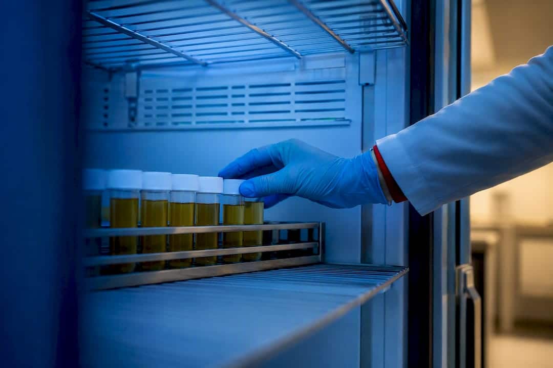 Refrigerated urine specimen rack in laboratory