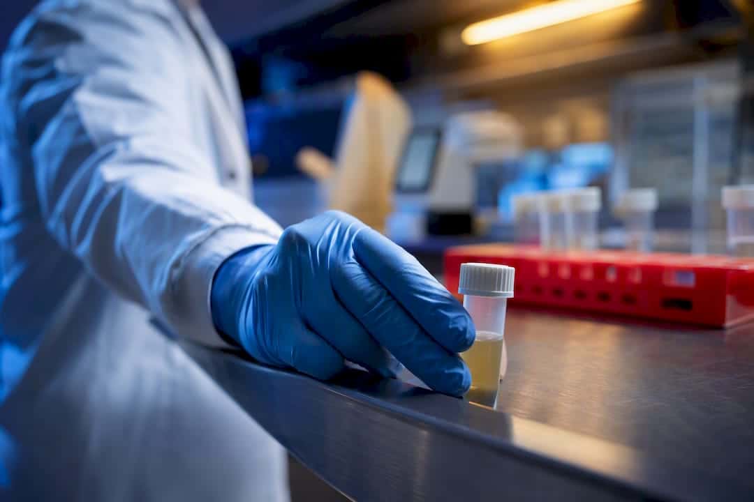 Anonymous urine specimen in toxicology laboratory
