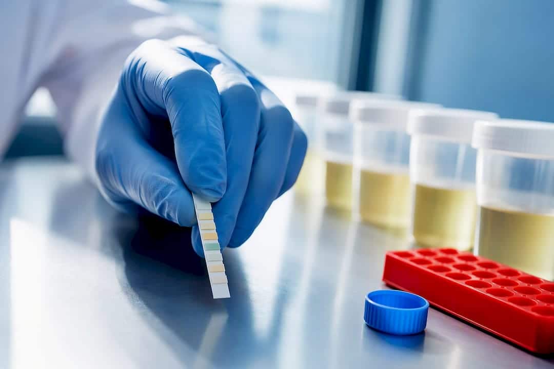 Technician examining anonymous drug test analyte windows