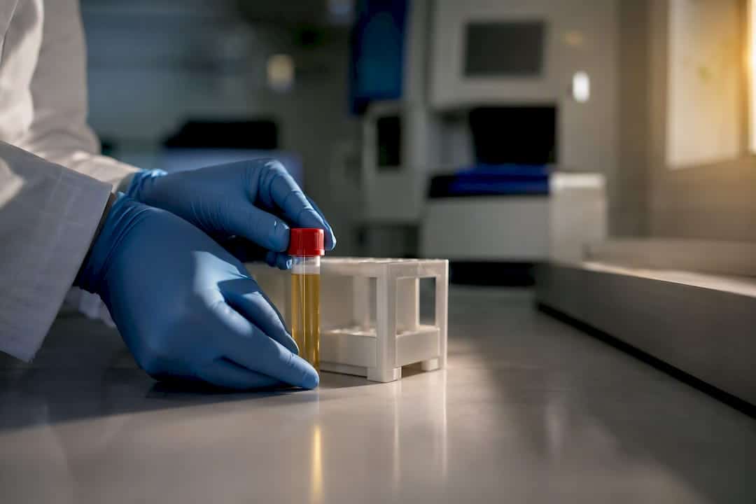 Urine specimen prepared for cotinine testing
