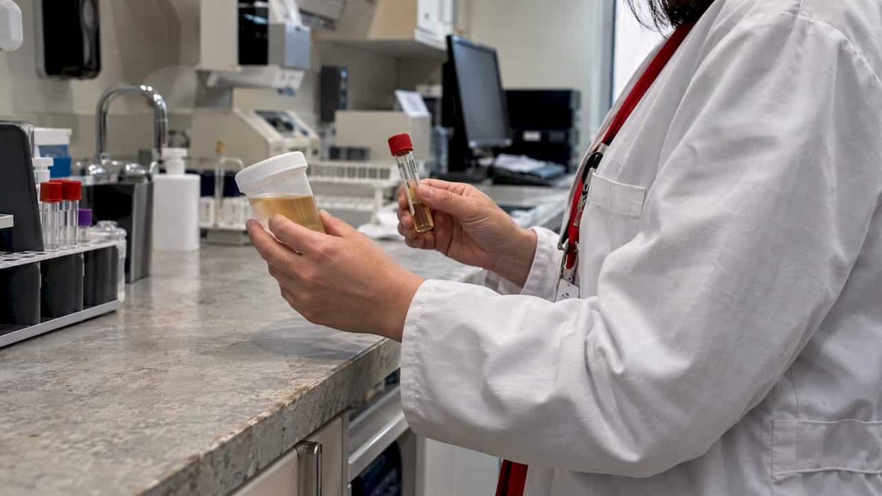 Clinician comparing urine testing options