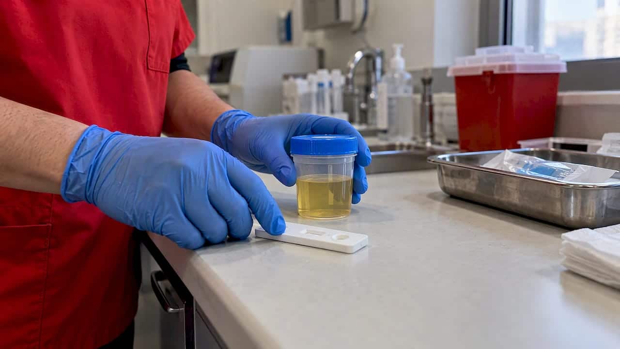 Urine specimen prepared for tramadol testing
