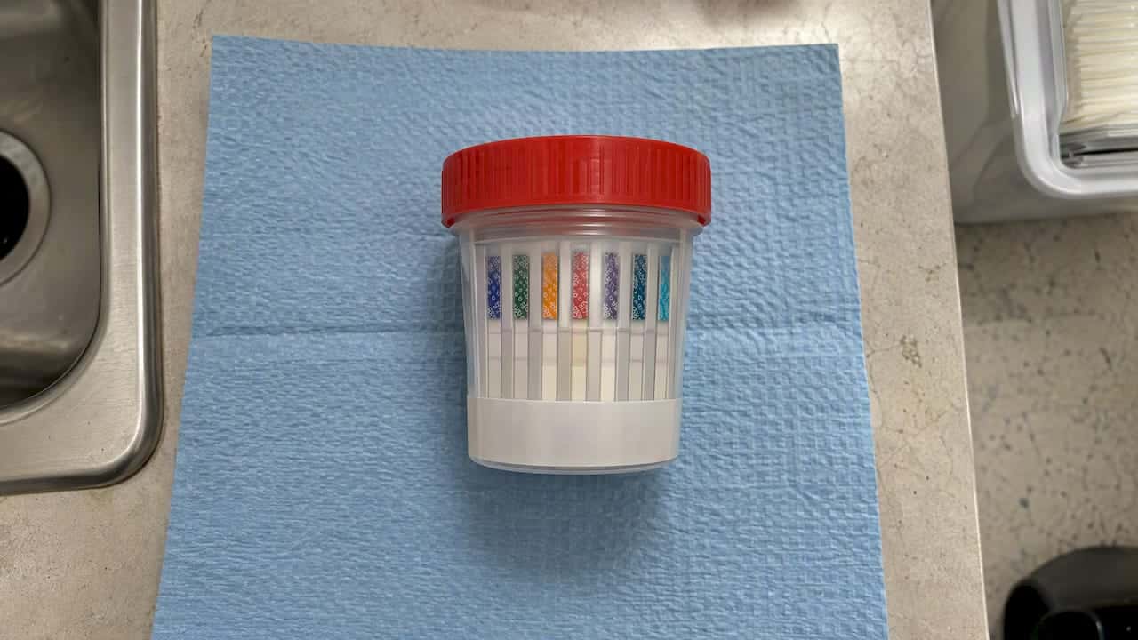Multi-panel urine test cup on blue pad