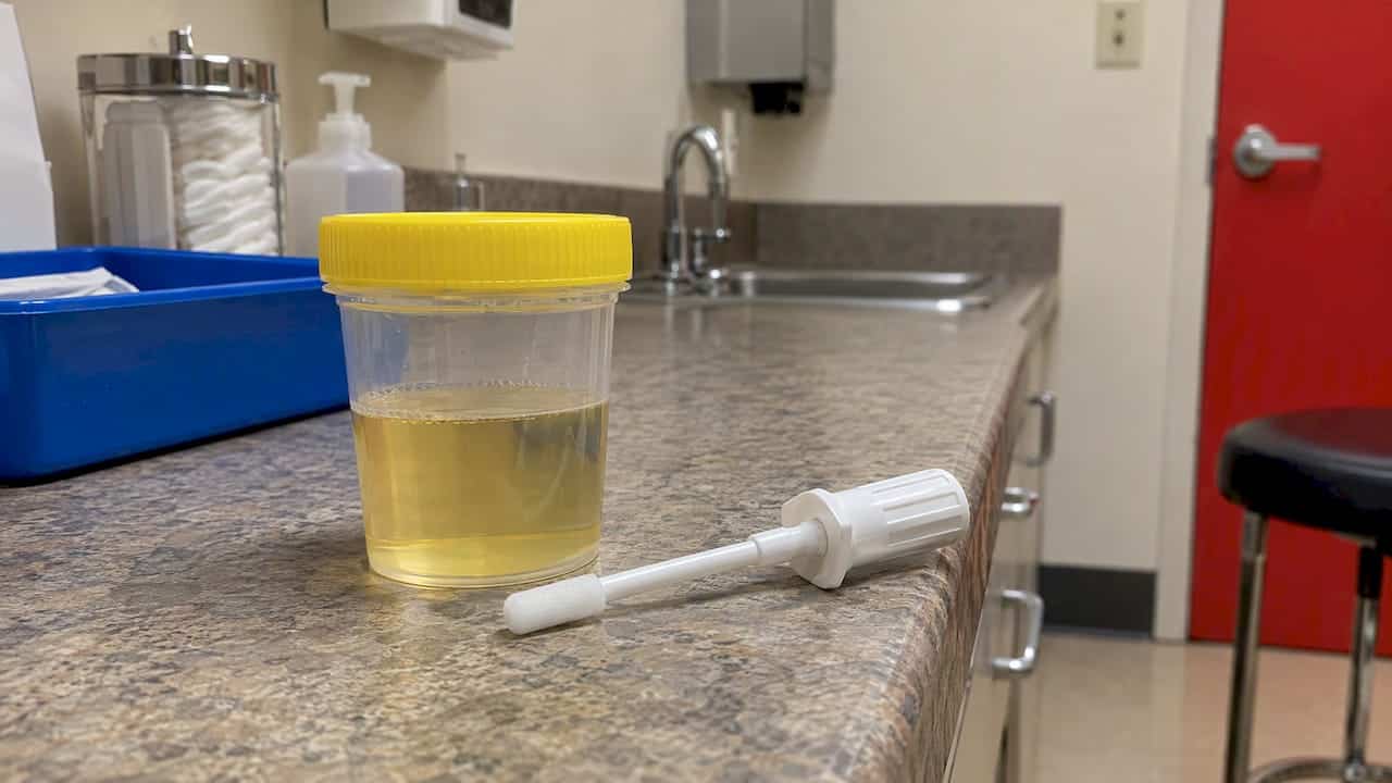 Urine cup and oral fluid collection swab